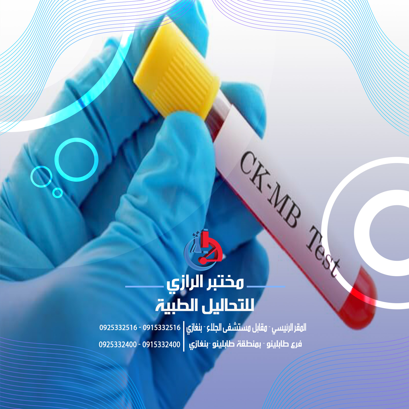 تحليل كرياتين كيناز القلبي