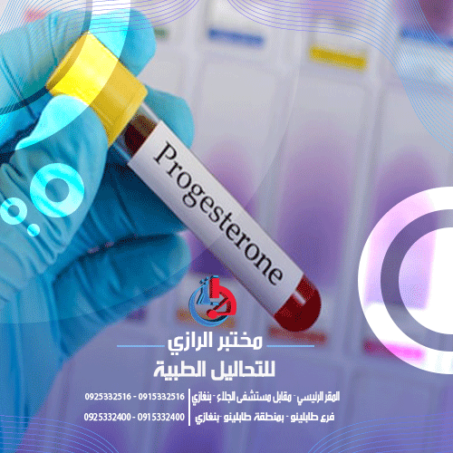 تحليل البروجسترون